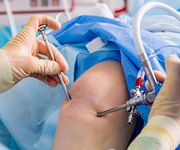 Knee Replacement Surgery