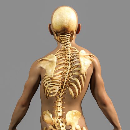 Scoliosis