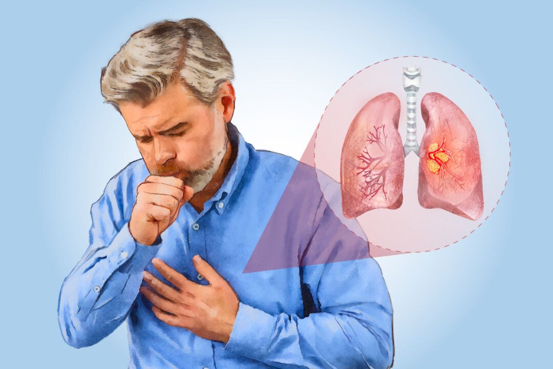 Lung Cancer Management
