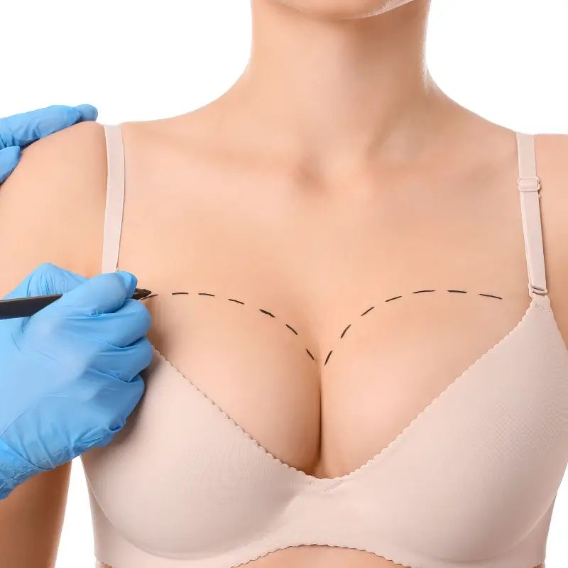 Breast Augmentation and Breast Reduction
