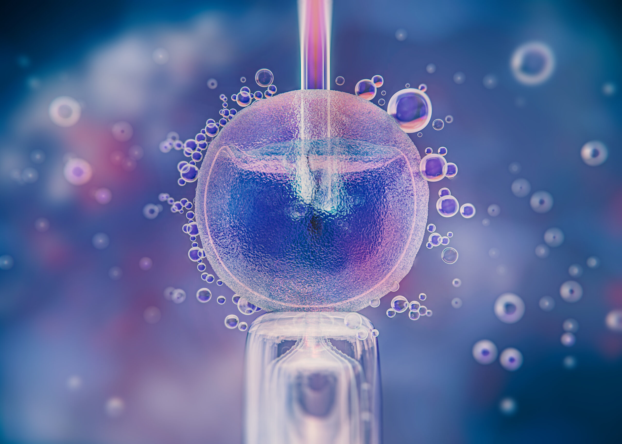Intracytoplasmic Sperm Injection (ICSI)