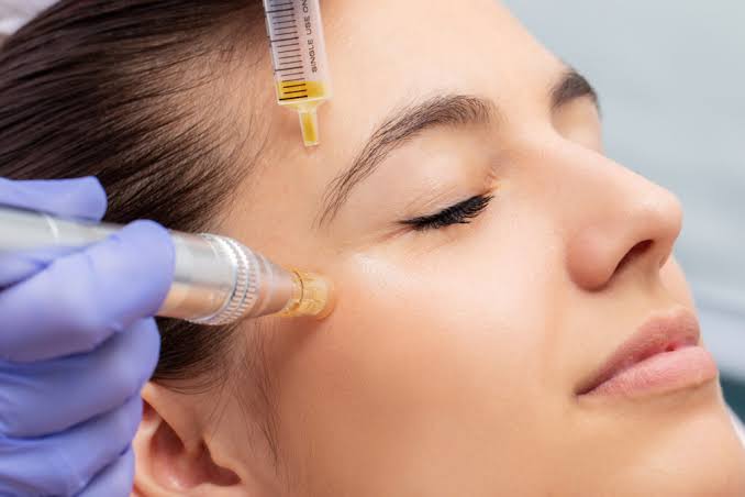 PRP Treatment (Platelet Rich Plasma)