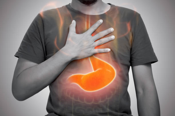 Treatment for Acid Reflux & GERD