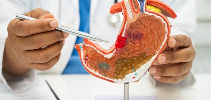 stomach-cancer